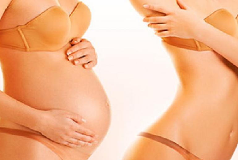 mommy makeover